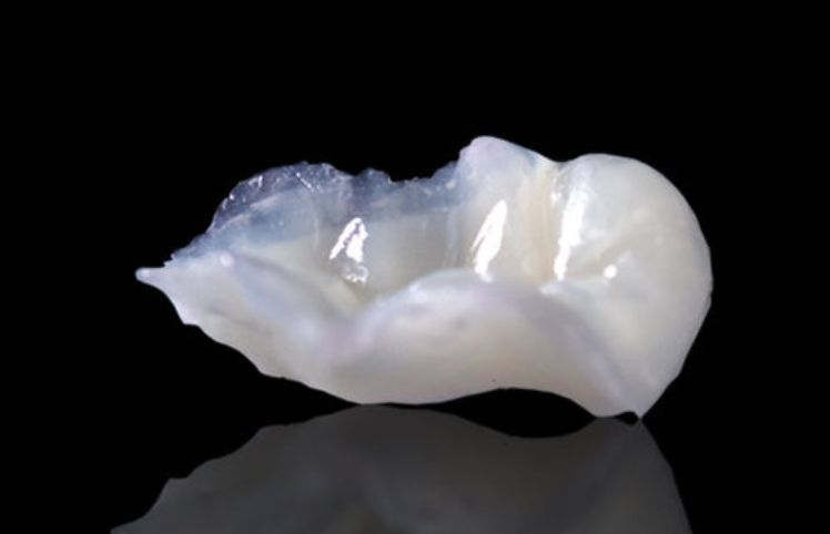Composite restorations offer dentists a true-to-nature restoration that is designed to parallel the physiological aspects of natural teeth. Technicians can achieve consistent, accurate shade reproduction from case to case.