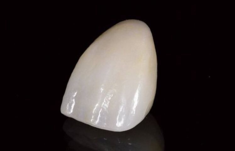 As the next generation of monolithic ceramics – ZirCAD Prime blends a high level of esthetics and strength into this Ivoclar-proven material. It’s innovative gradient technology, along with seamless shade progression and Zirconia durability, make it an ideal material for versatility.