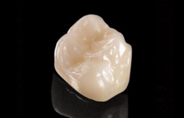 Introducing a new premium, highly translucent Zirconia material from Ivoclar Vivadent that provides natural-looking properties inspired by the esthetics of e.max lithium disilicate.