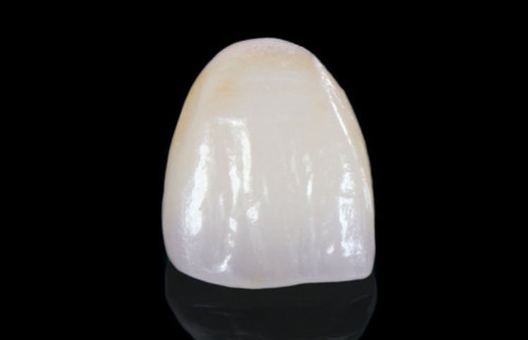 With versatility, reliability and longevity in mind… e.max is unmatched in clinical success. With biocompatible lithium disilicate ingots, e.max offers optimized esthetic properties, creating restorations that offer true-to-nature results.